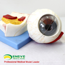 EYE05 (12529) Modelo de globo ocular Medical Anatomy, 5 veces su tamaño normal, 7 piezas, modelos de ojos, nariz, garganta y garganta&gt; Modelos de ojos